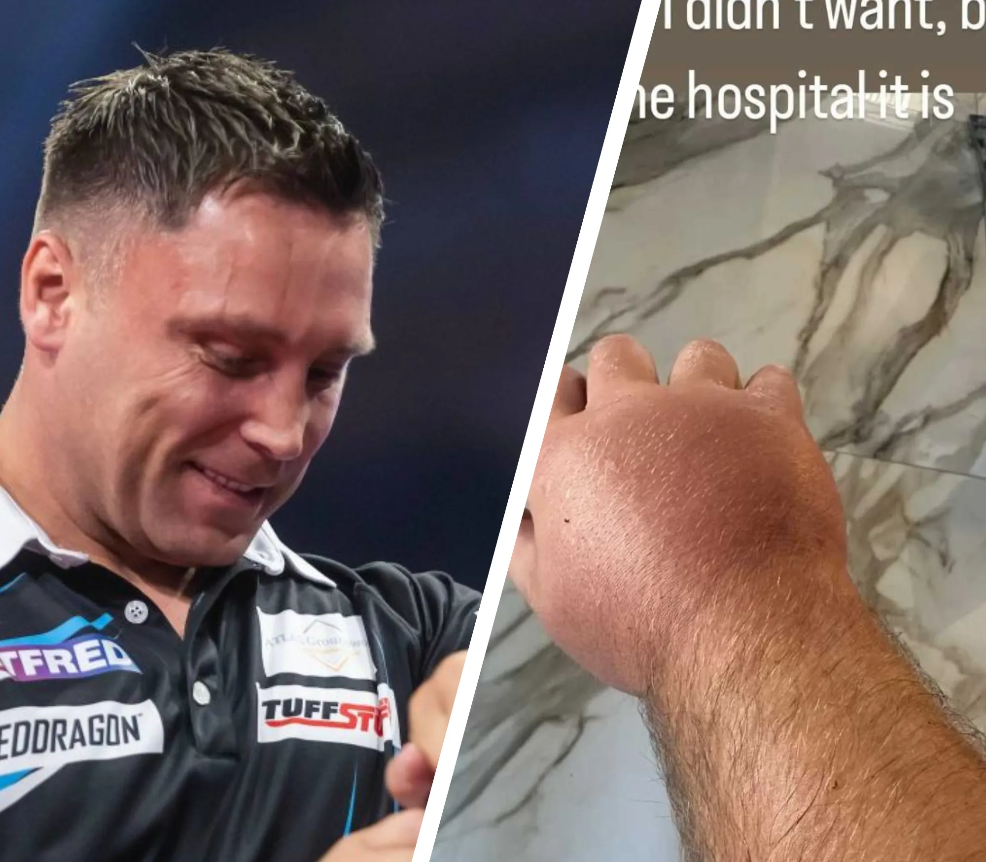 "Net wat ik niet wilde, terug naar het ziekenhuis" - Gerwyn Price mist Players Championship 24 door opgezwollen hand