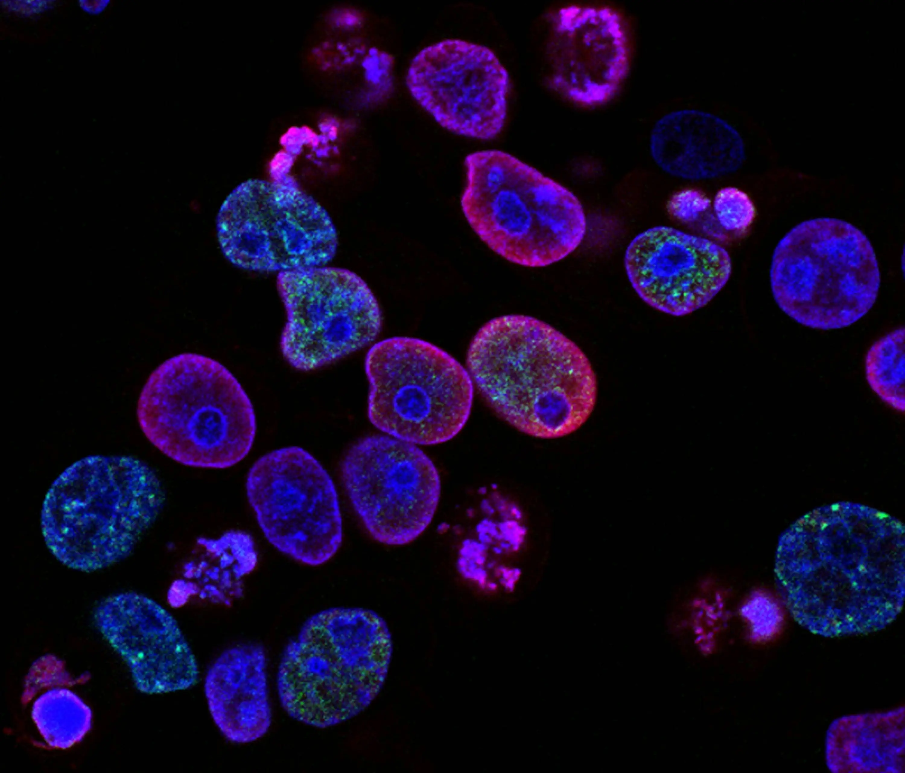 national cancer institute L7en7Lb Ovc unsplash