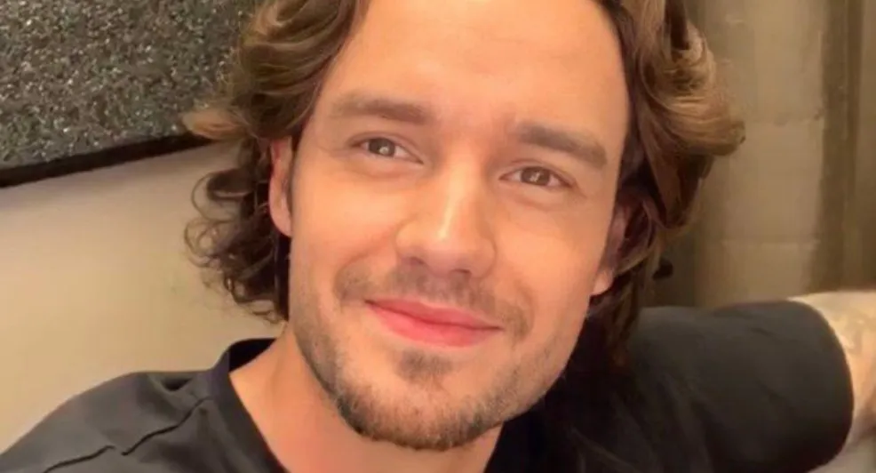 Bizar: oud One Direction-lid Liam Payne heeft cosmetische ingreep gedaan