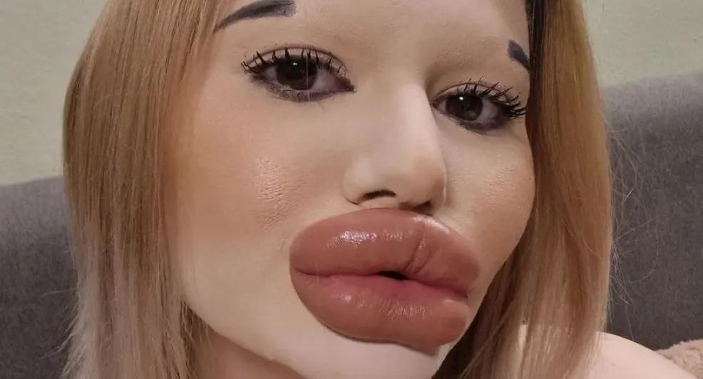 vrouw allergrootste lippen