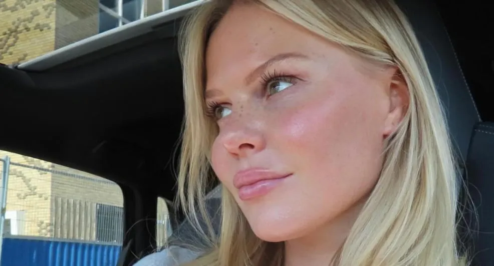 Vocht in je gezicht? Probeer de Koreaanse beautyhack: twee elastiekjes om je oren