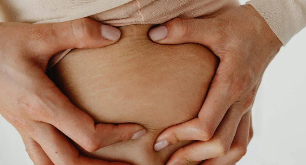 3 producten die helpen tegen striae en stretchmarks