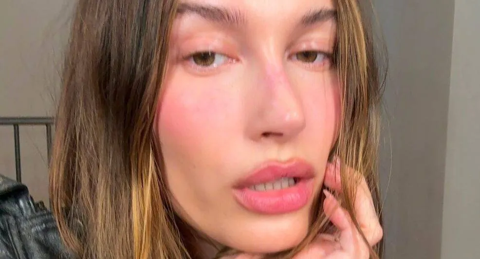 hailey bieber rhode skin