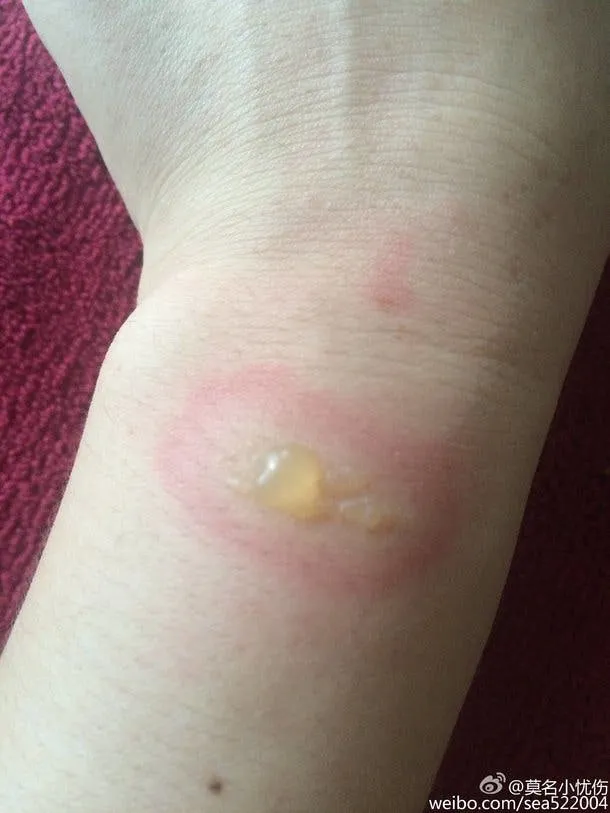 0a0edc00 5a23 11e6 a56f d7765ecf938f