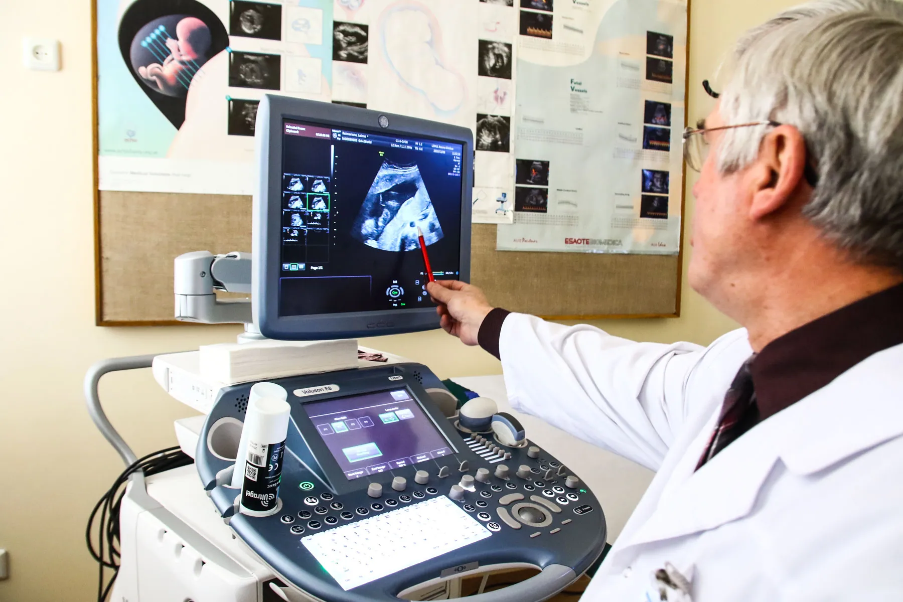 Kūdikiui penkis kartus perpiltas kraujas