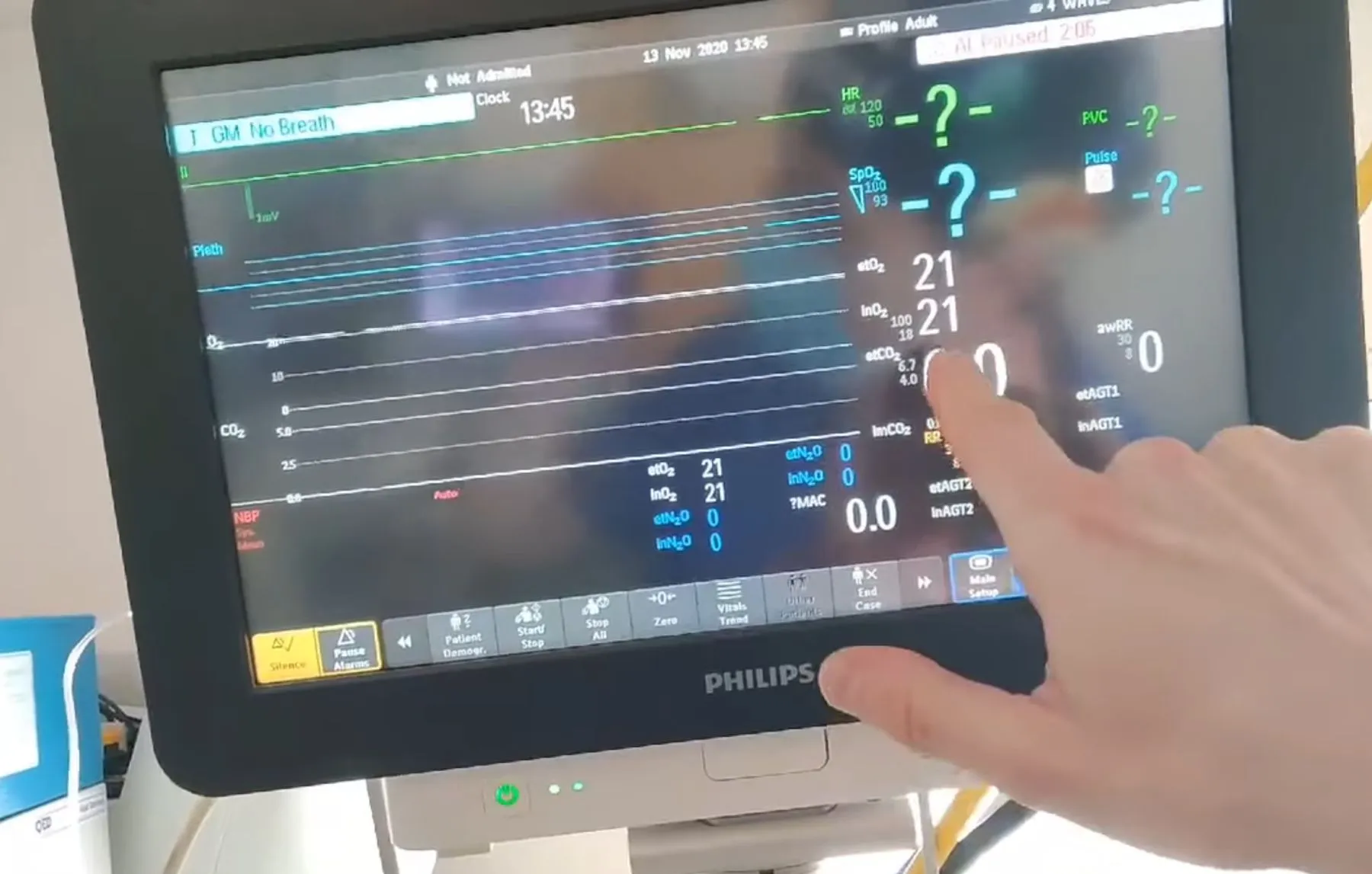 Deguonis ir anglies dvideginis po kauke