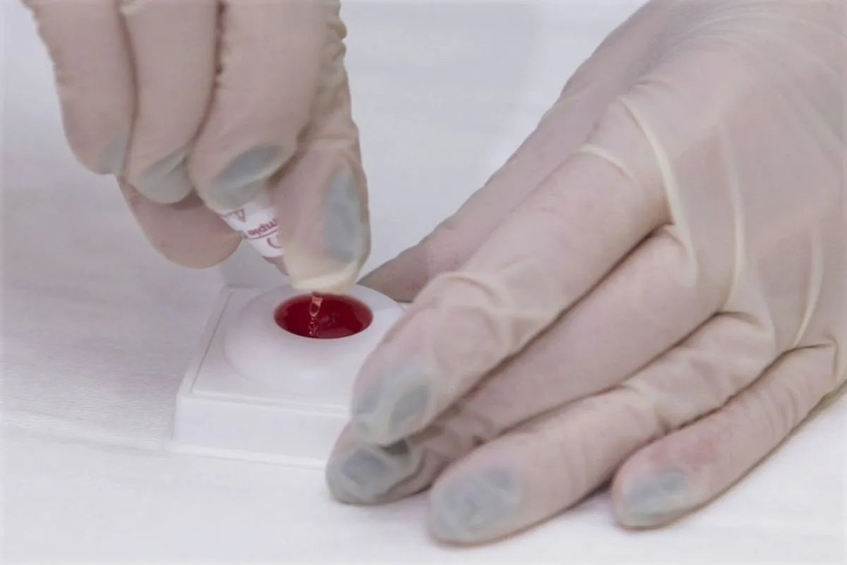 ŽIV, AIDS, kraujo tyrimas