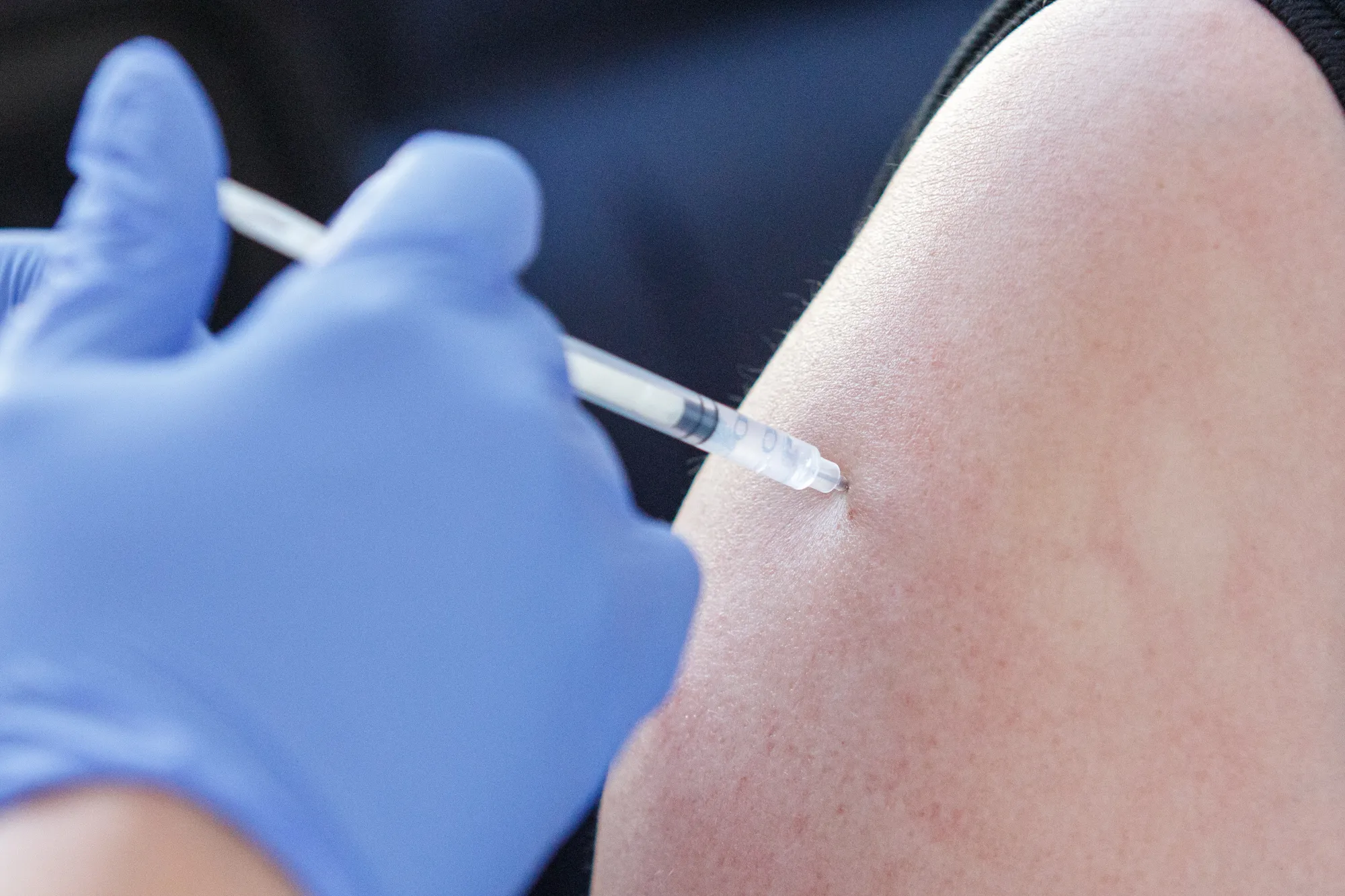 Vakcinacija Akropolyje