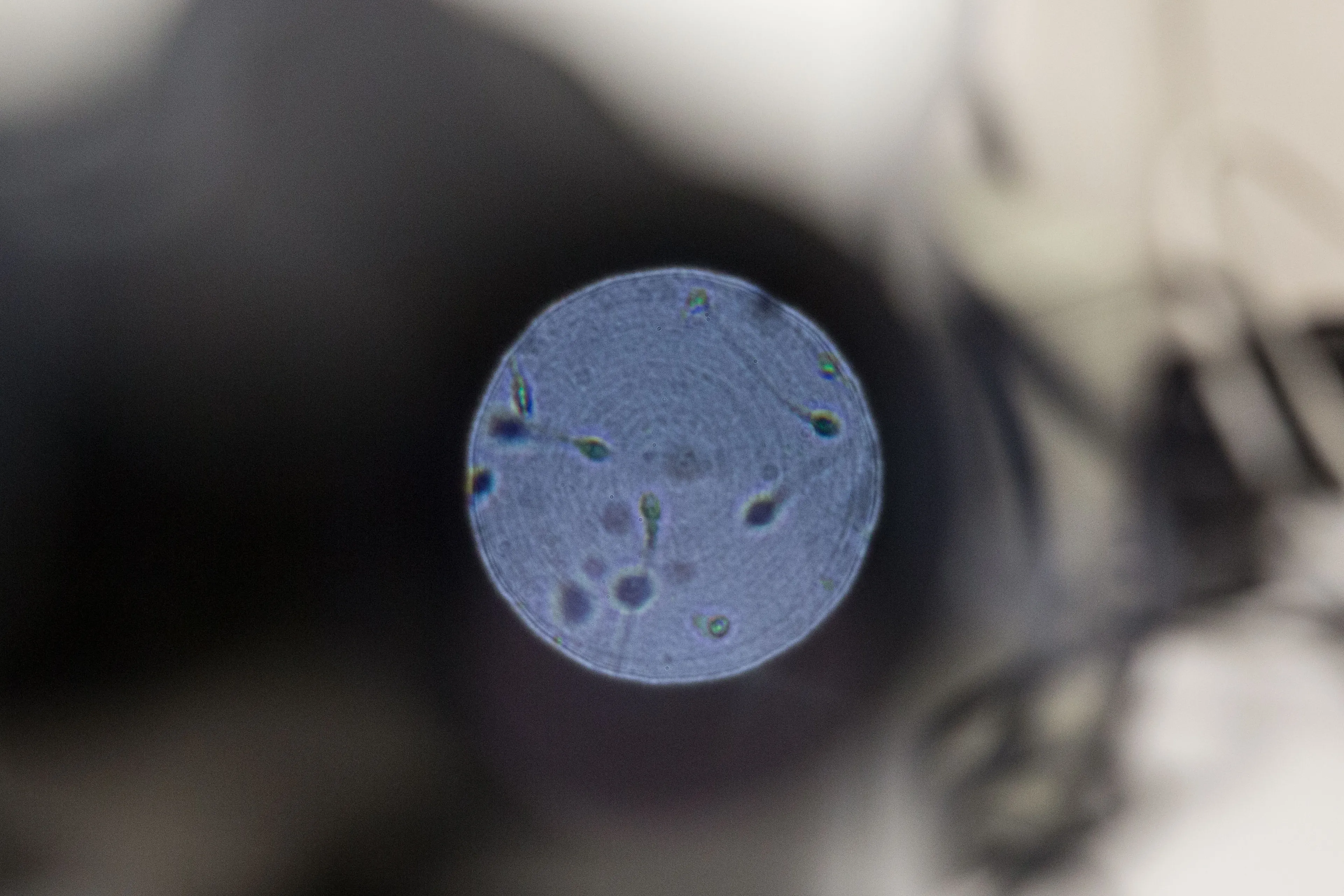 Pagalbinis apvaisinimas