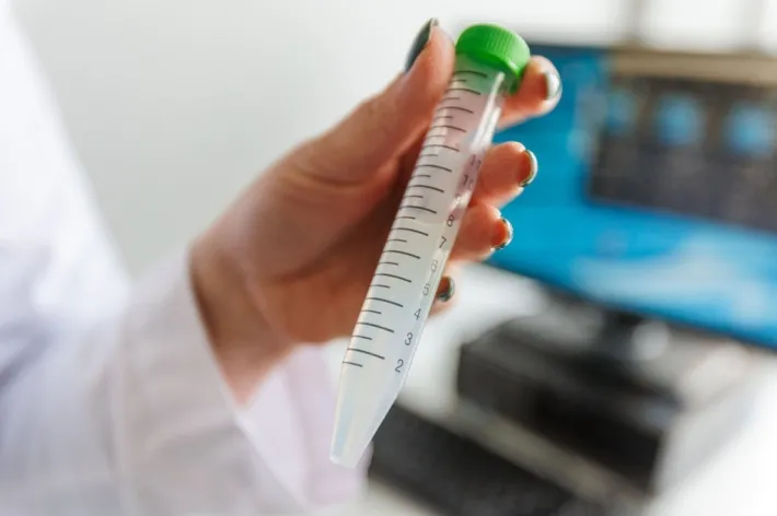 Tyrimas, mėgintuvėlis