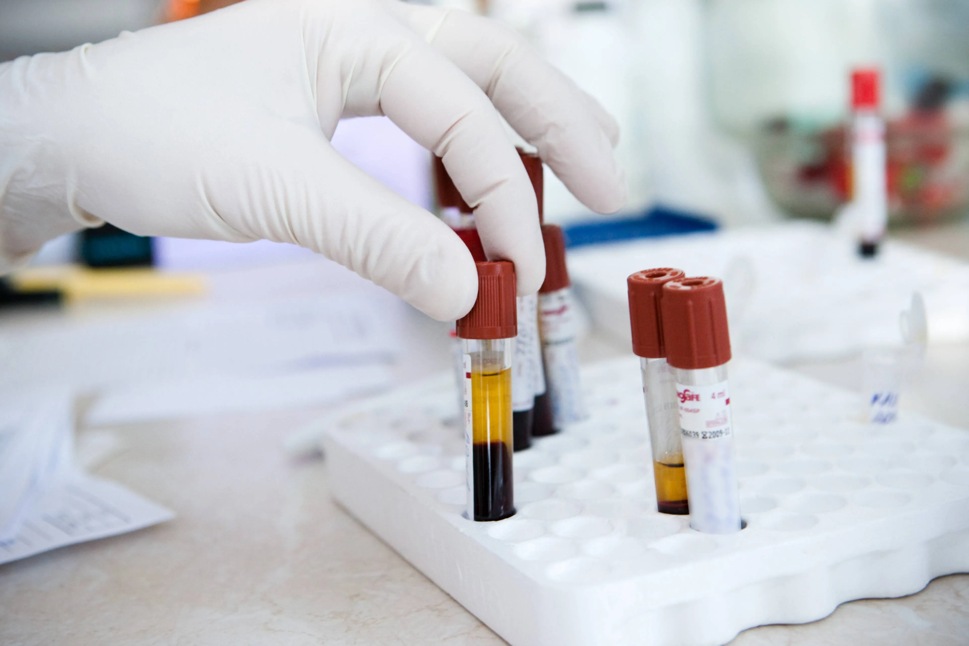 Kraujas, kraujo tyrimai