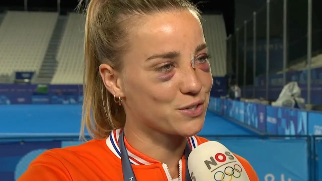 Hockeyster Joosje Burg verschijnt zwaar gehavend voor de camera