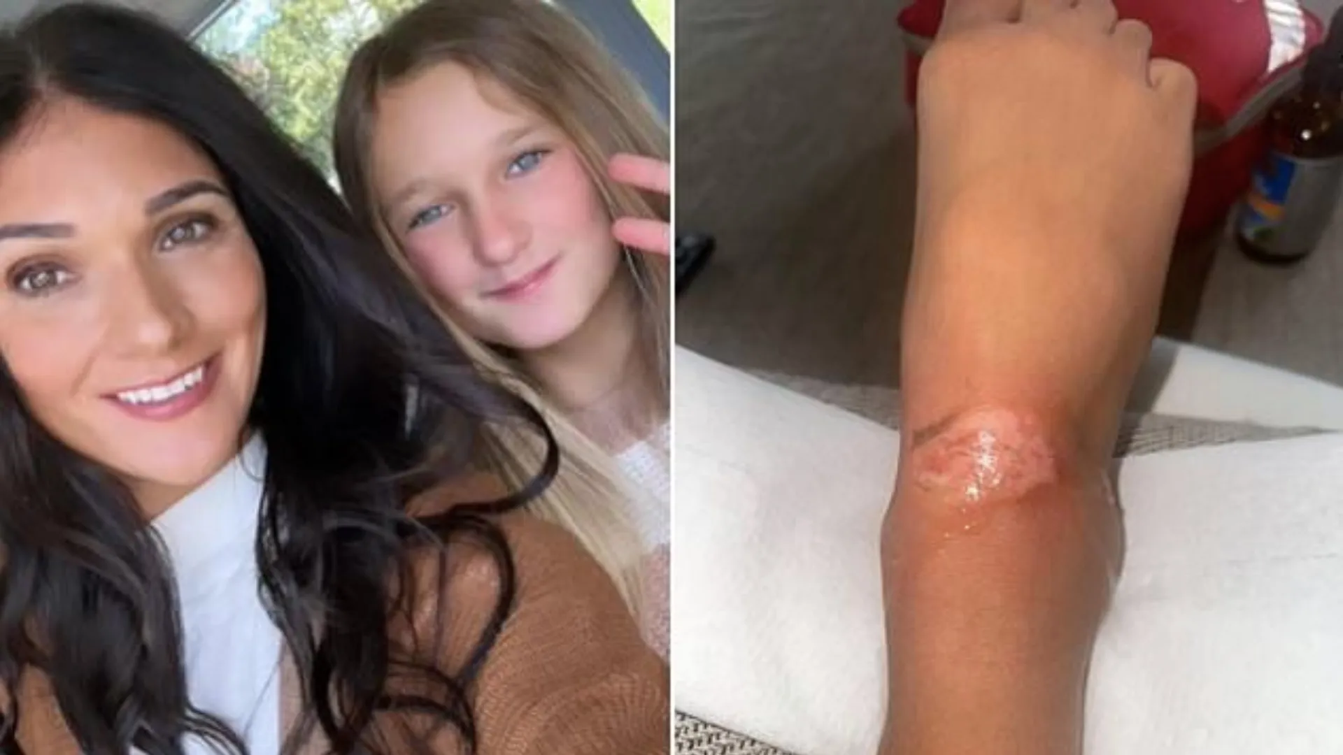 Beautyroutine loopt uit op nachtmerrie voor elfjarig meisje