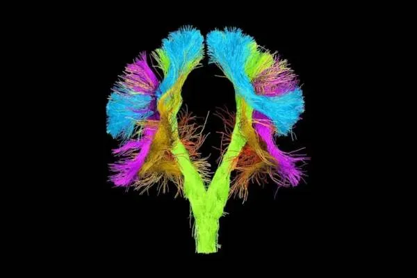 neurochirurgie-foto-2-web800-600x400