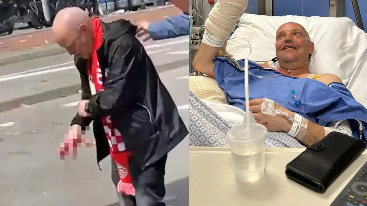 PSV-fan die hand kwijtraakte door vuurwerk is cultheld Appie uit Probleemwijken