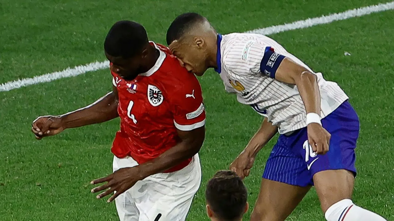 Mbappé verschijnt eerder dan verwacht terug op het trainingsveld, laat masker achterwege en laat zien hoe zijn neus eruitziet