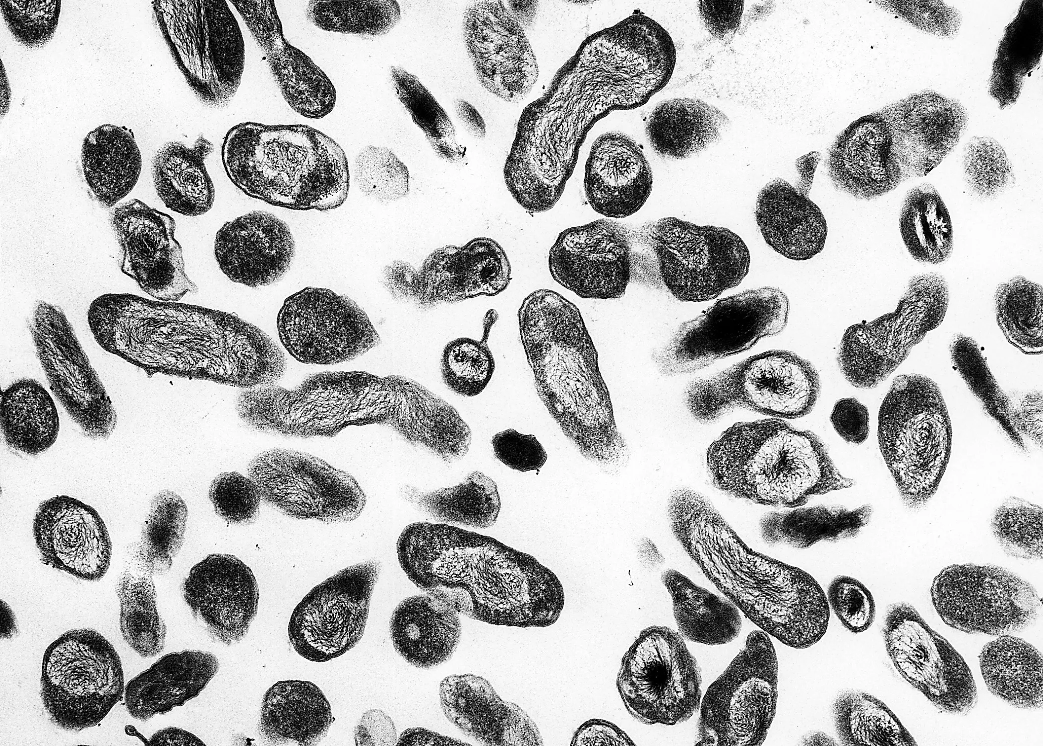 coxiella burnetii 01 q koorts