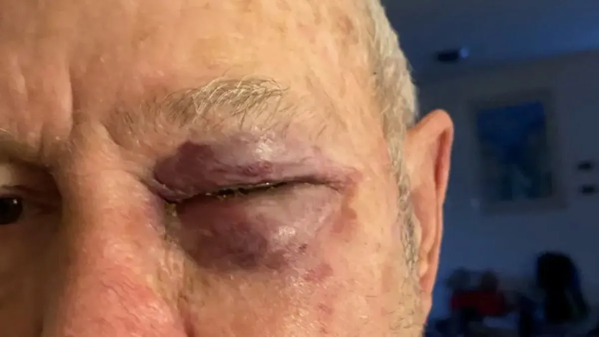 Nikkede 77-årig fodbolddommer en skalle – Får sin dom i dag