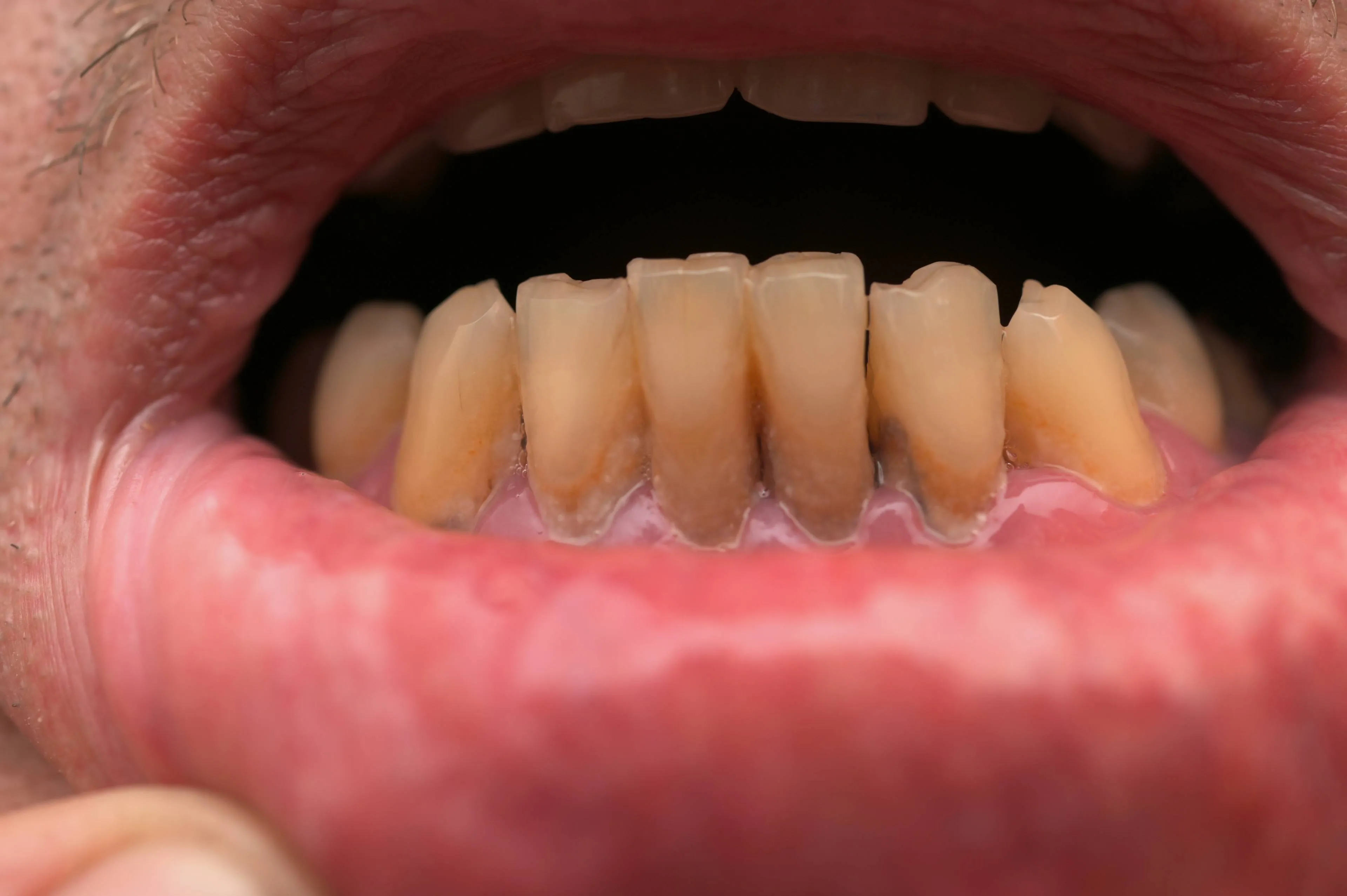 shutterstock_2589416985