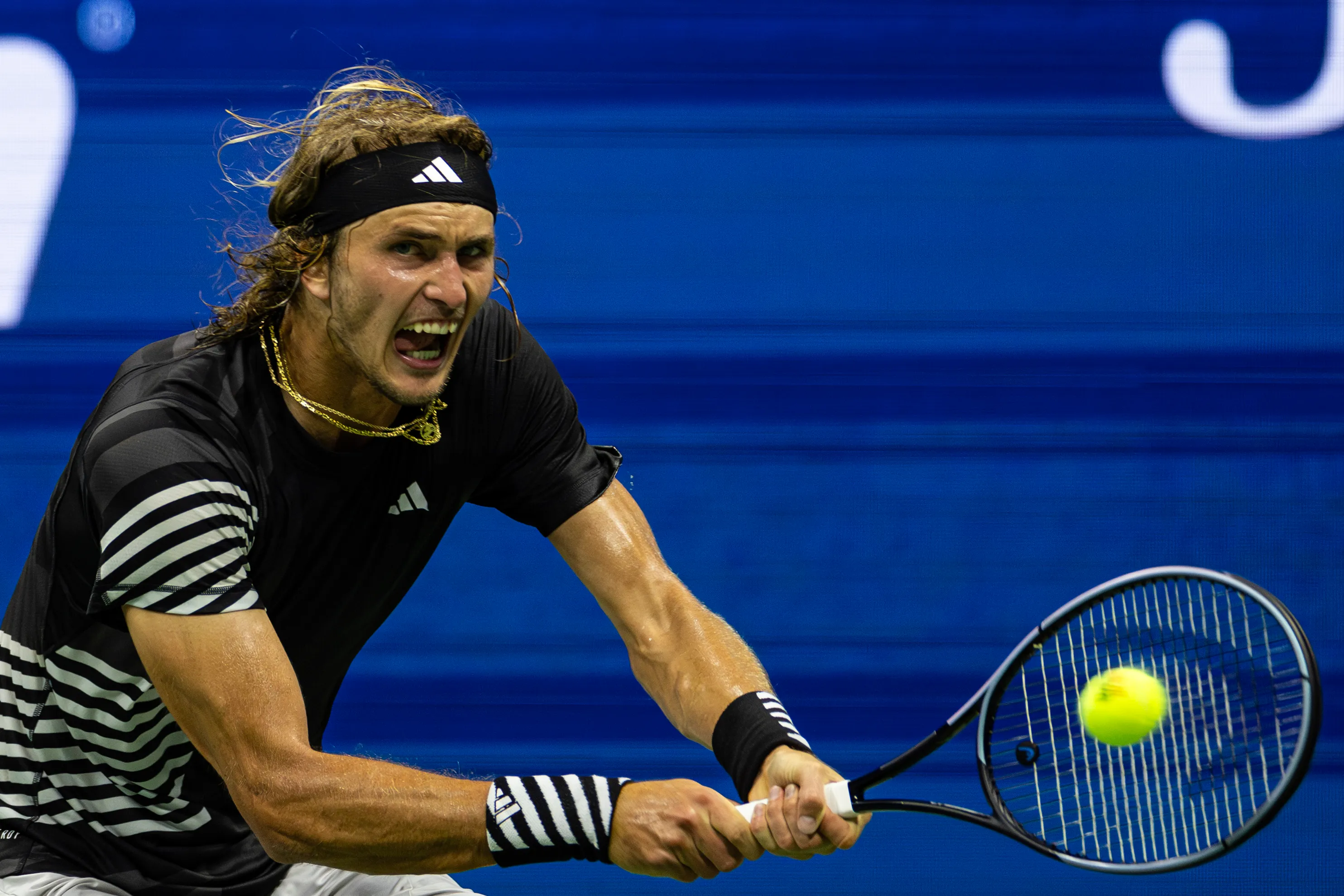 'Hate It': Zverev Explains Why He Refused To Call Doctor Despite Being Injured At US Open
