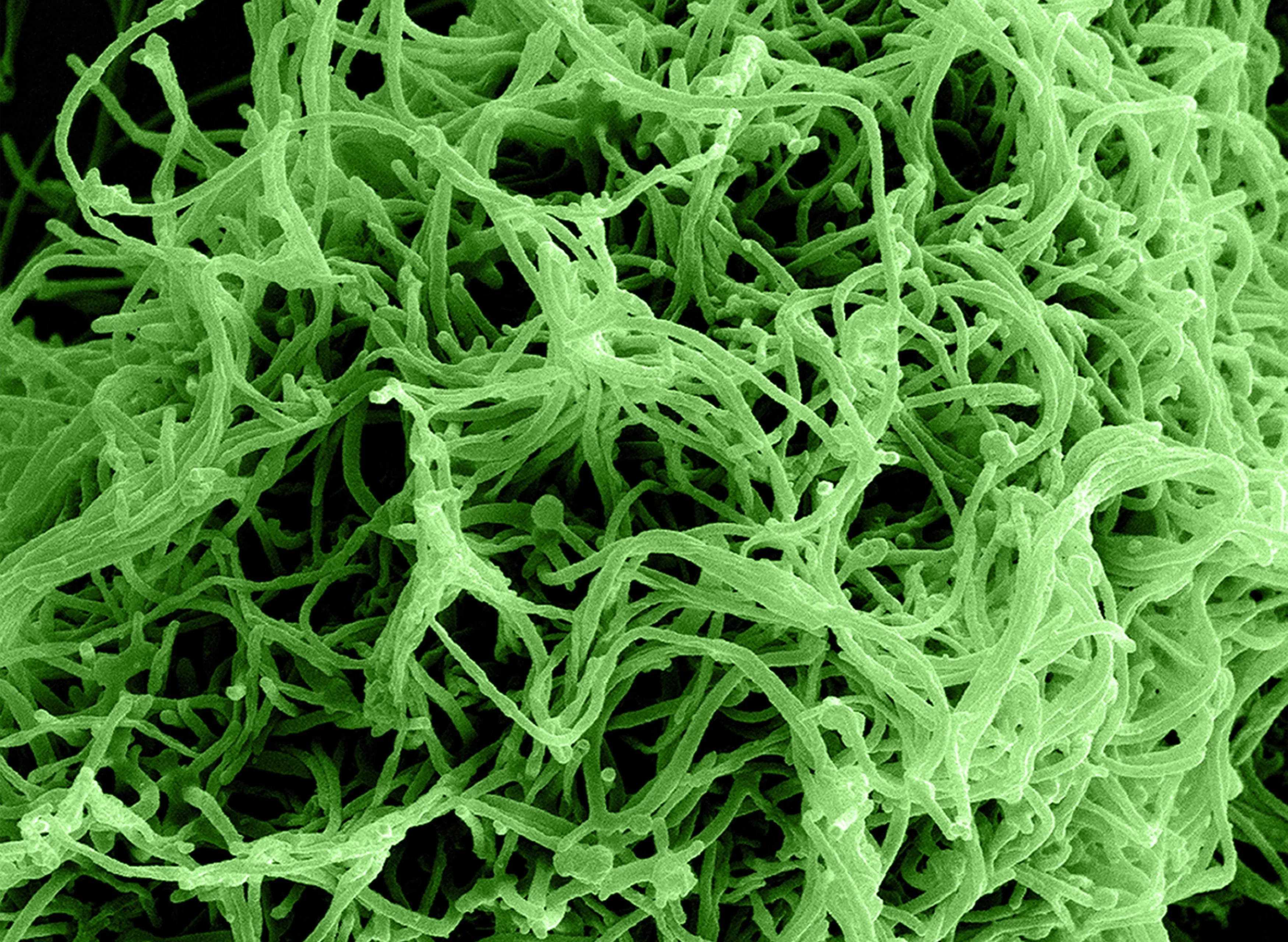 Ontdekker van Ebola waarschuwt voor apocalyptische ‘Ziekte X’: “We moeten allemaal bang zijn