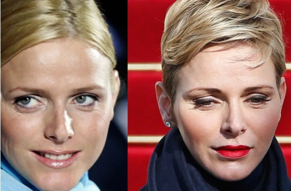 Charlene van Monaco ging net iets te vaak naar plastische chirurg