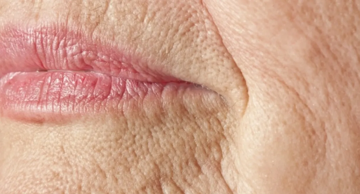 De strijd tegen de rimpels: stamcelextracten, antioxidanten, fruitzuren, hyaluronzuur, vitaminen, allemaal dure, nutteloze onzin.
