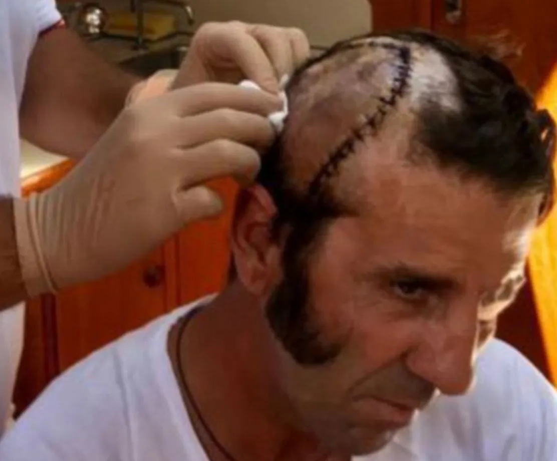 Spaanse matador deels gescalpeerd tijdens stierengevecht