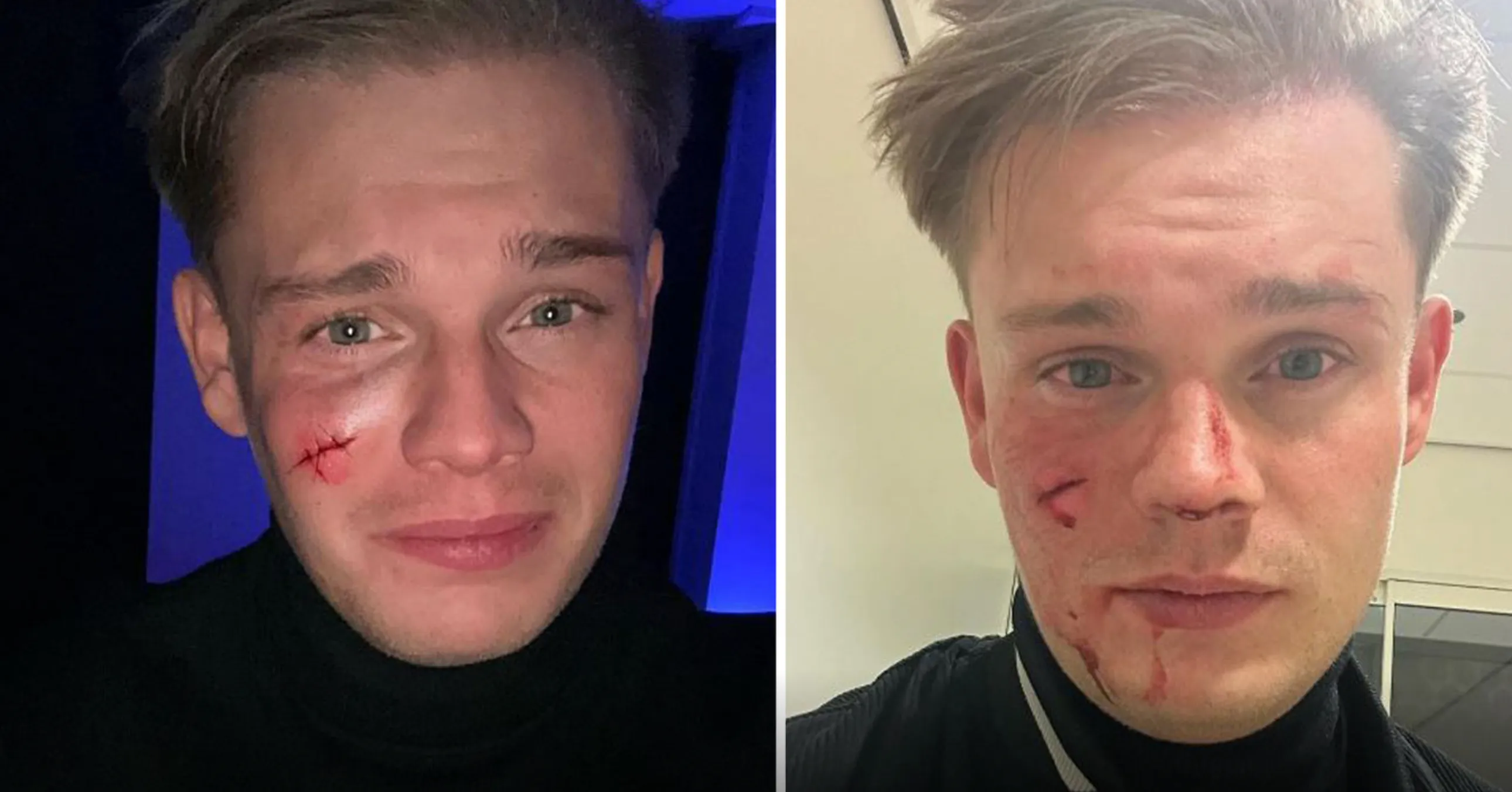 Roddelpraat-maker Dennis Schouten in bar in gezicht gestoken