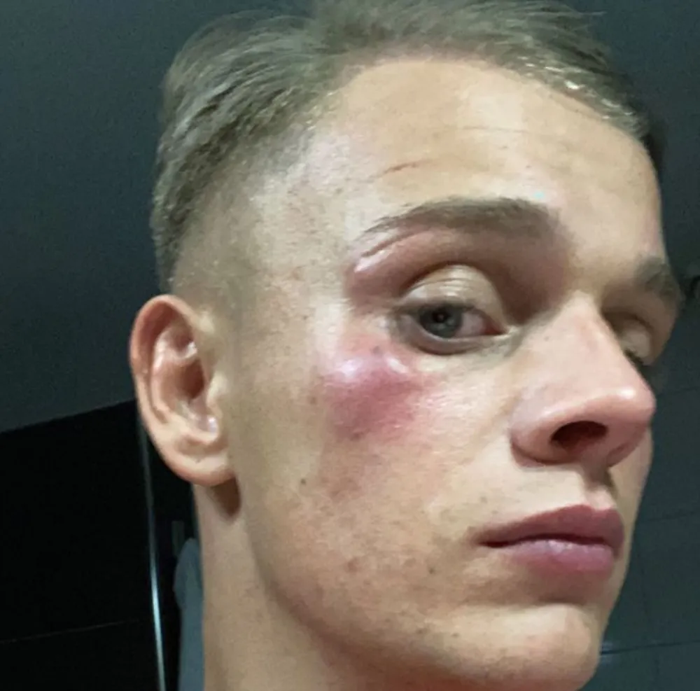 Dennis Schouten (PowNed) krijgt klappen