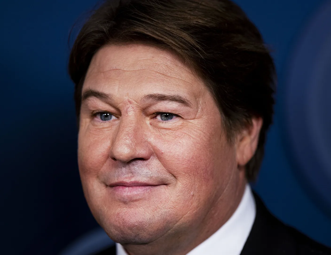 Martijn Krabbé heeft vorm van kanker, nog meerdere behandelopties