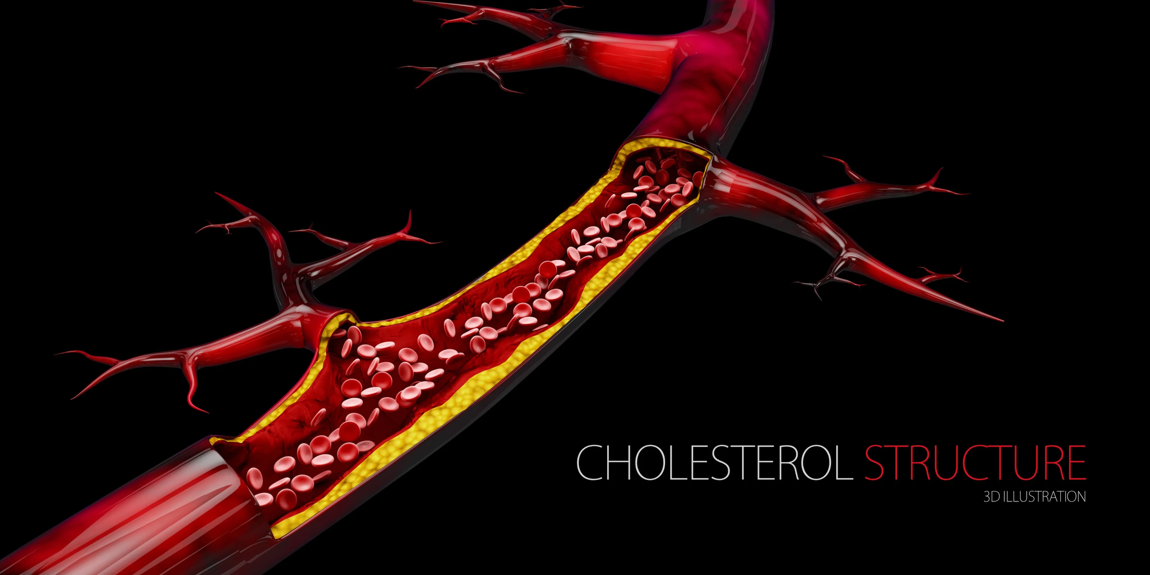 'Cholesterol wordt pas gevaarlijk als er te veel van op de verkeerde plek terechtkomt'