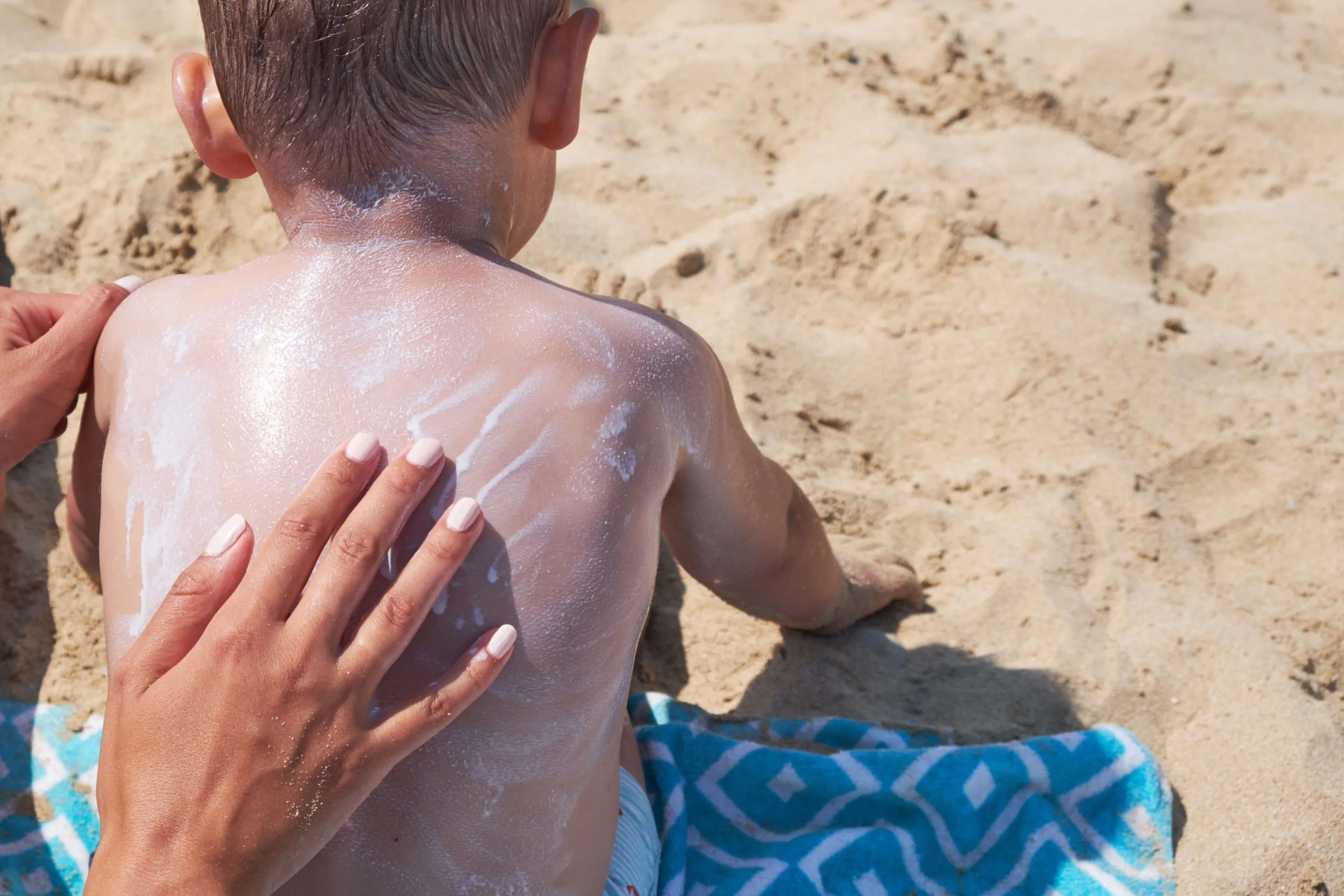 Moet factor 50 zonnebrand echt? Ook al in de lente?