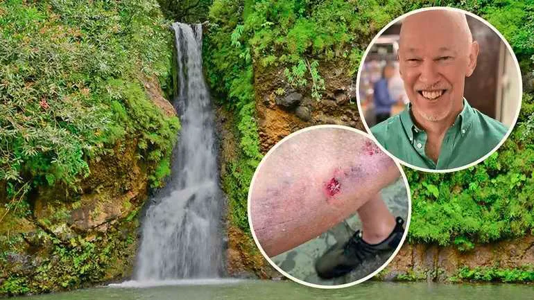Horrorvakantie: toerist loopt schaafwondje op in Turkije en sterft dagen later door vleesetende superbacterie