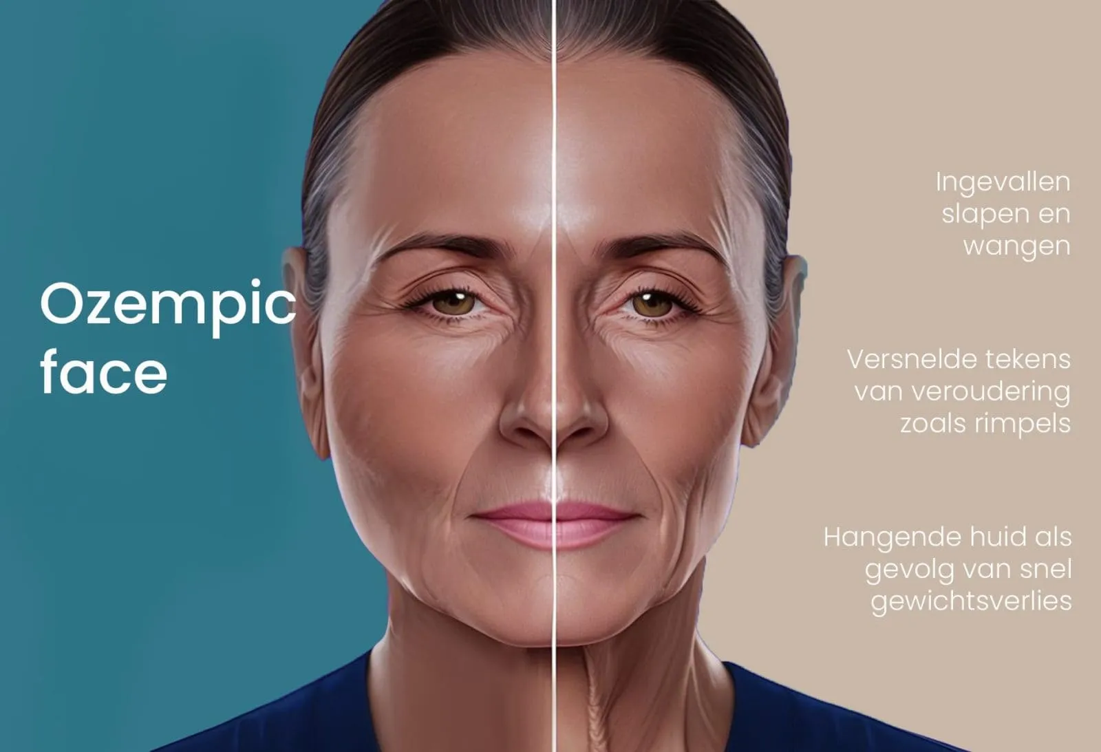Ozempic-gezicht: De verwoestende gevolgen van Ozempic