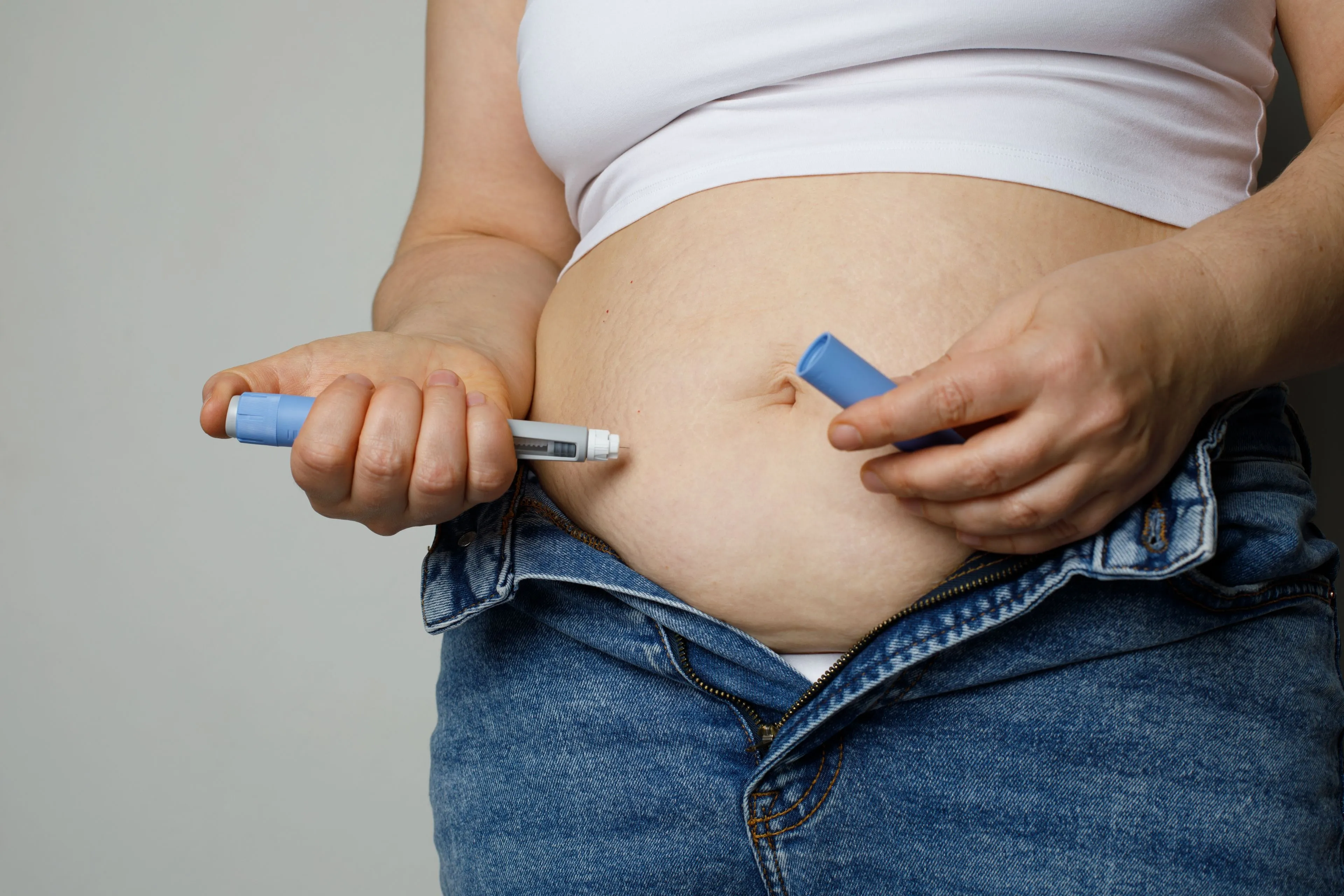 Is obesitas een ziekte? Het was het niet, maar nu is het een ziekte geworden