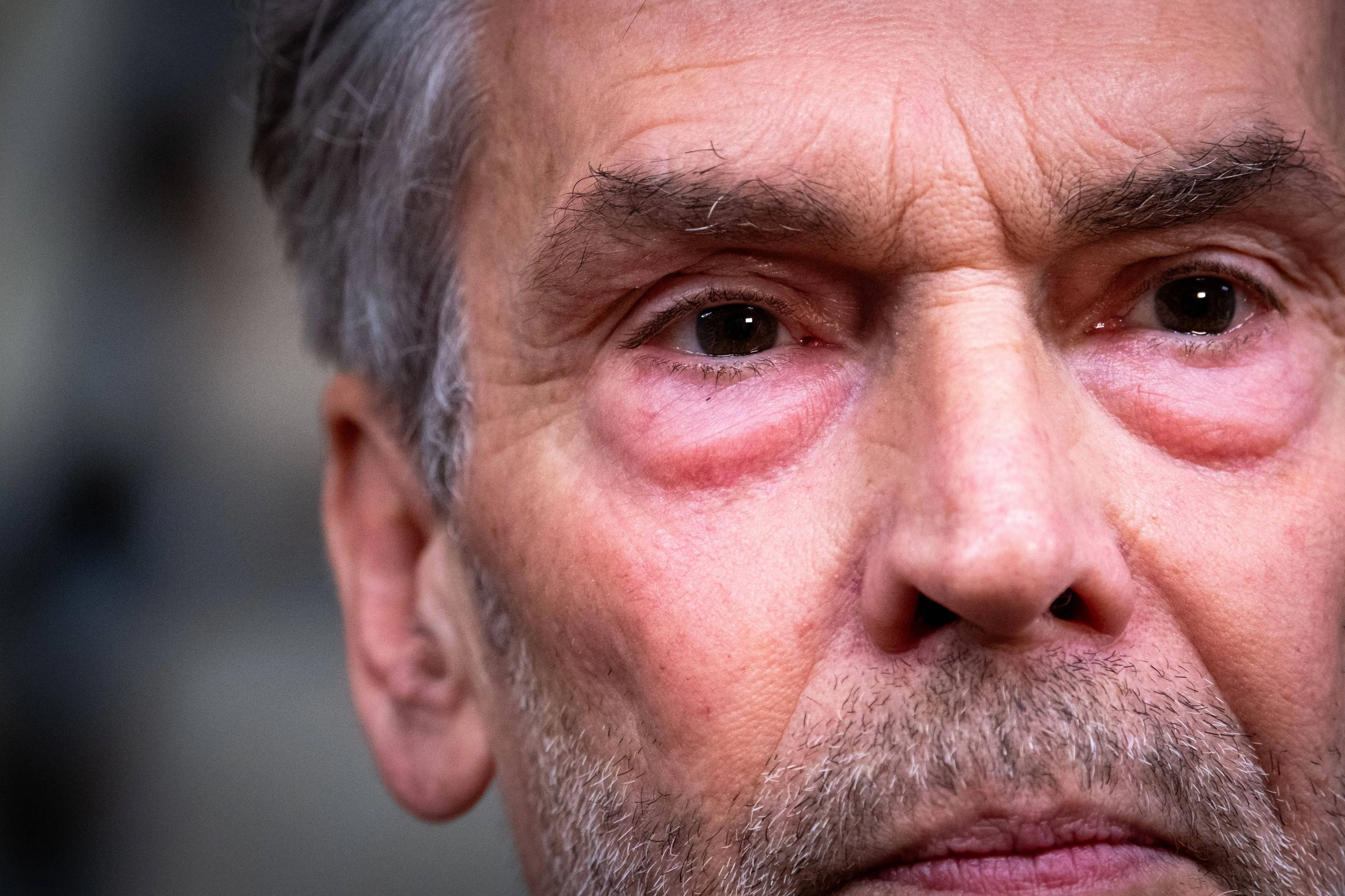 Schoof heeft nog steeds griep, premier Luxemburg valt in