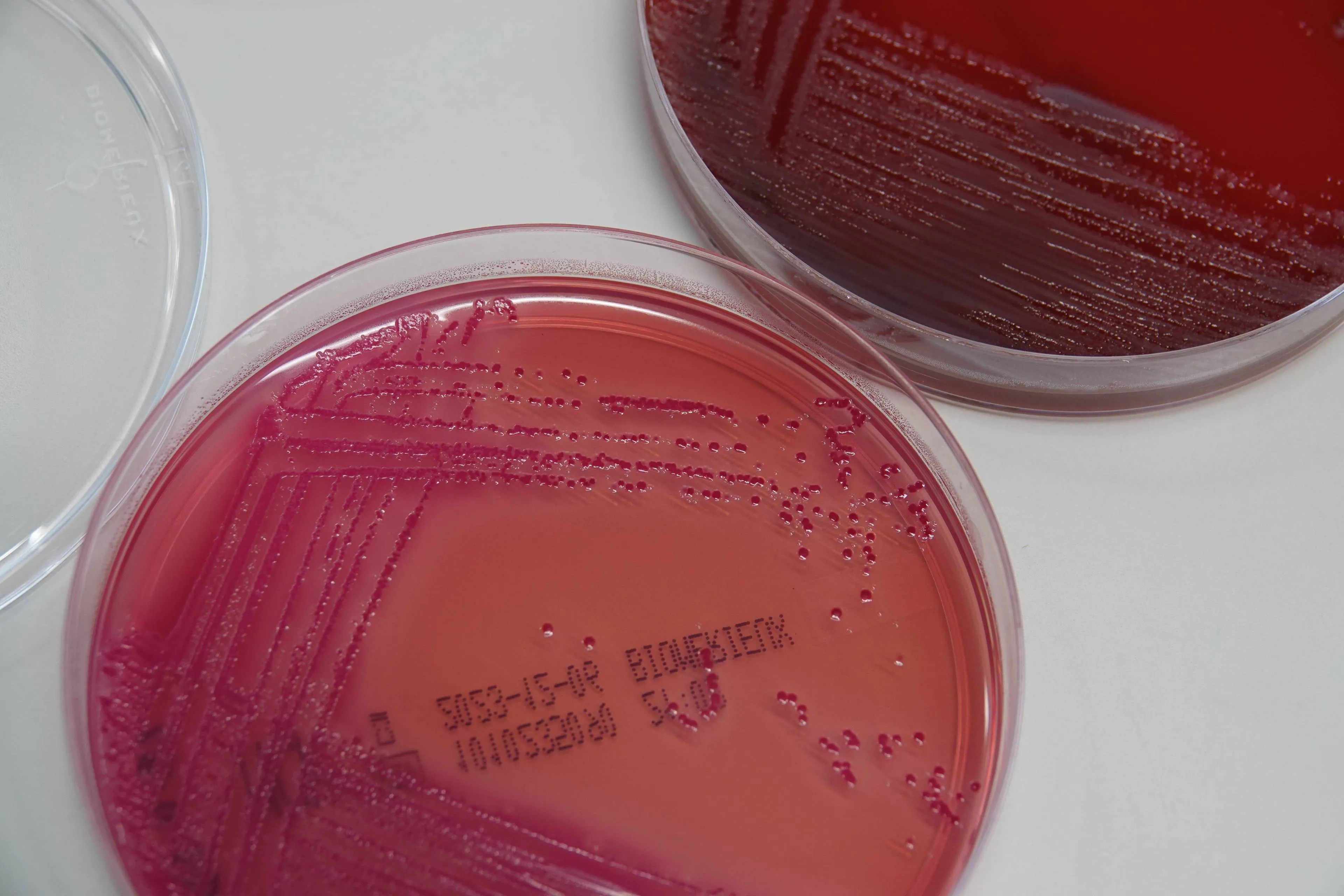 Nieuw onderzoek: superbacteriën dreigen miljoenen doden te veroorzaken; bestrijding kost 2000 miljard per jaar in 2050
