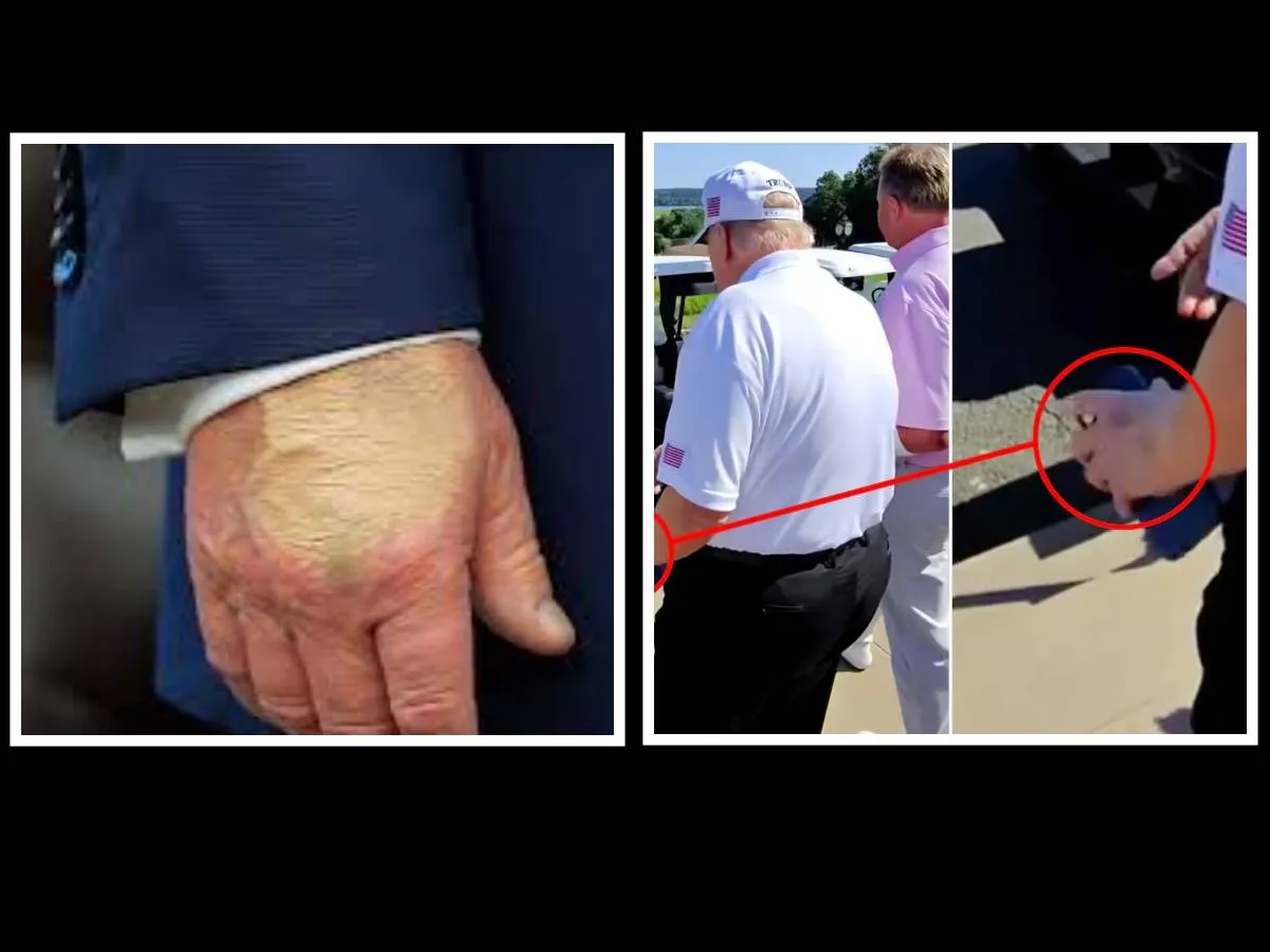 Het geheim van de handen van Trump