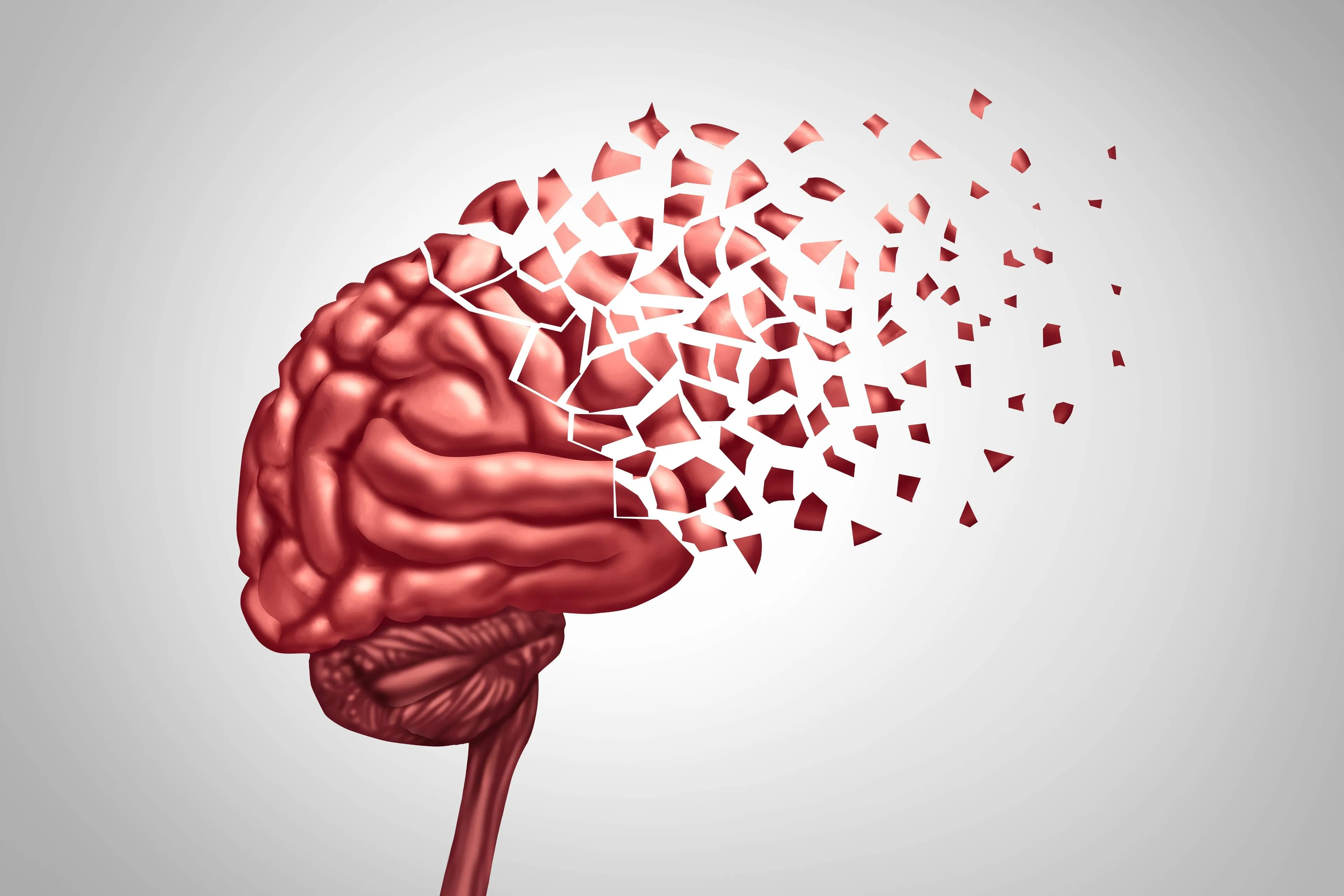 5 vroege tekenen van Alzheimer die je niet mag negeren
