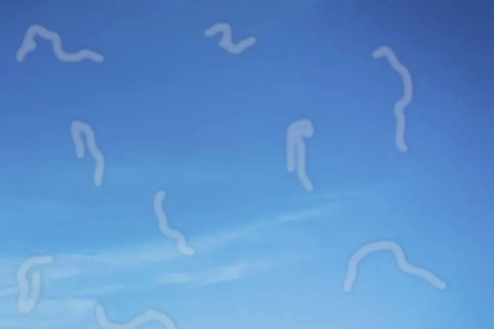 Zie jij ook van die zwevende vlekjes? Dit is wat ‘floaters’ zijn (en wanneer je naar de oogarts moet)