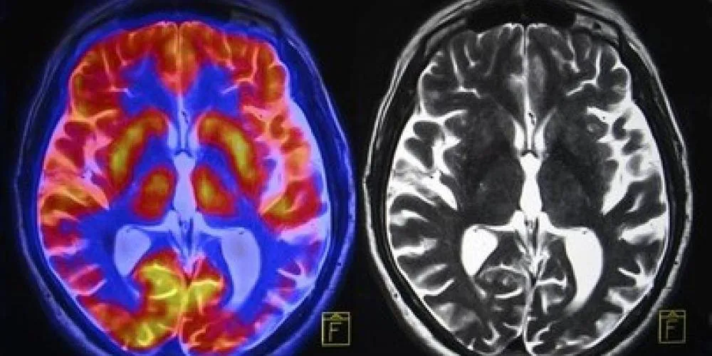 brain-scan-260nw-273127421