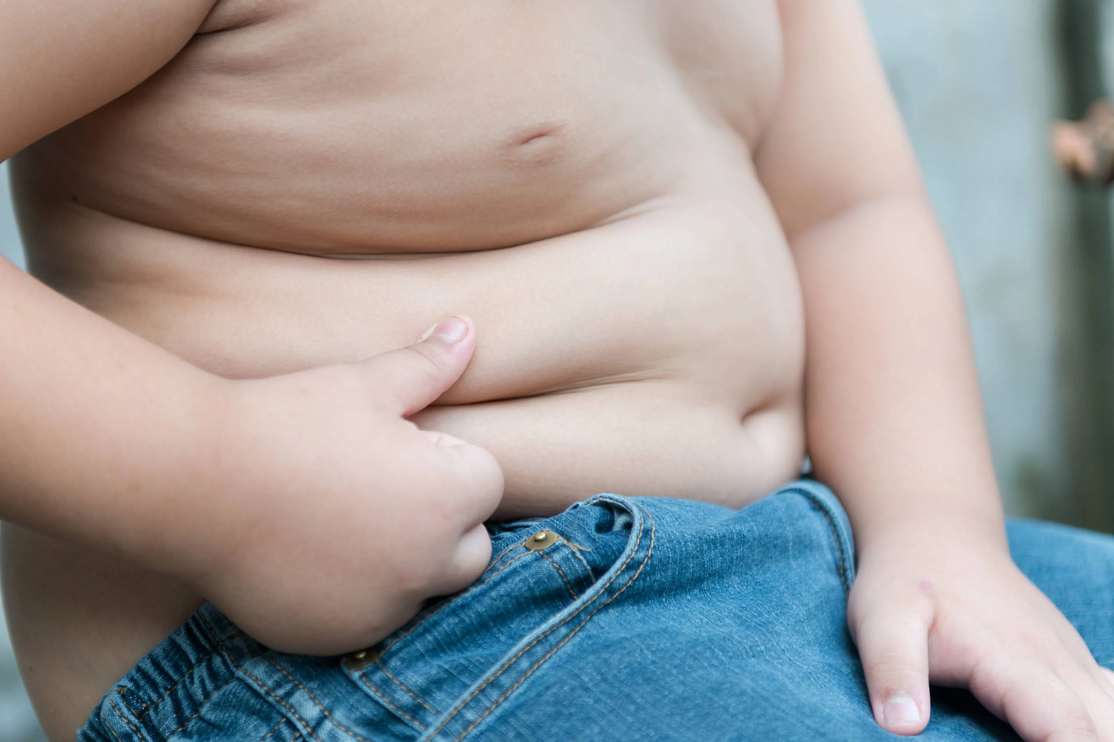 Kinderartsen zien alarmerende stijging van obesitas bij kinderen