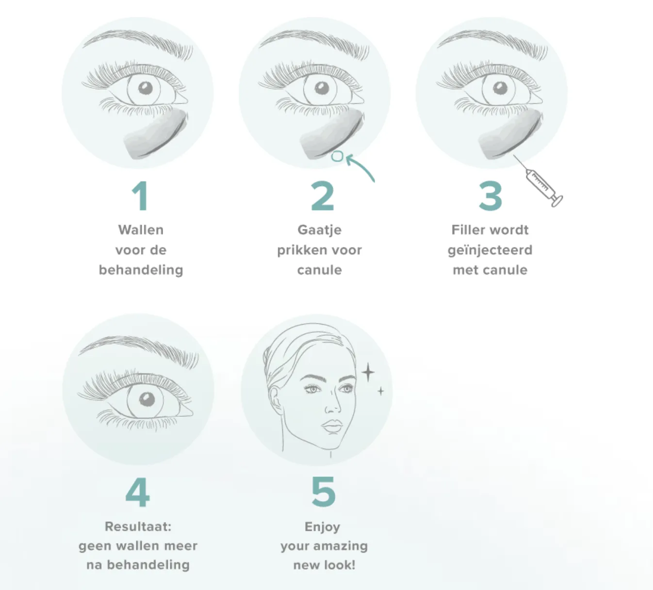 Steeds meer jonge vrouwen willen traangootfillers: hoe onschuldig is het echt?