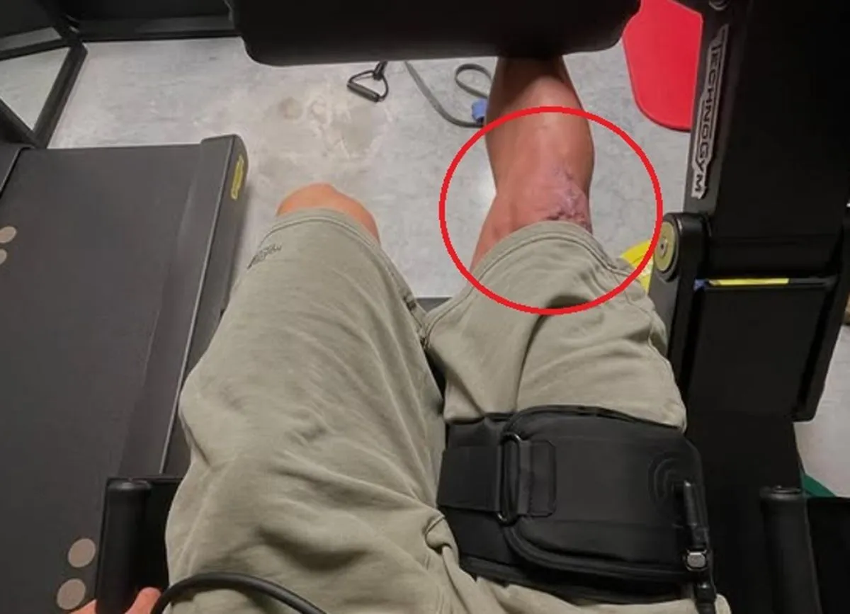 Wout van Aert deelt beelden van flink gehavende knie
