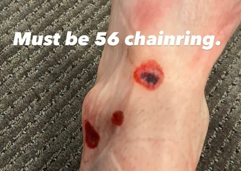 Klassementsrenners meten schade op na massale valpartij op zaterdag: wie zijn er geraakt?