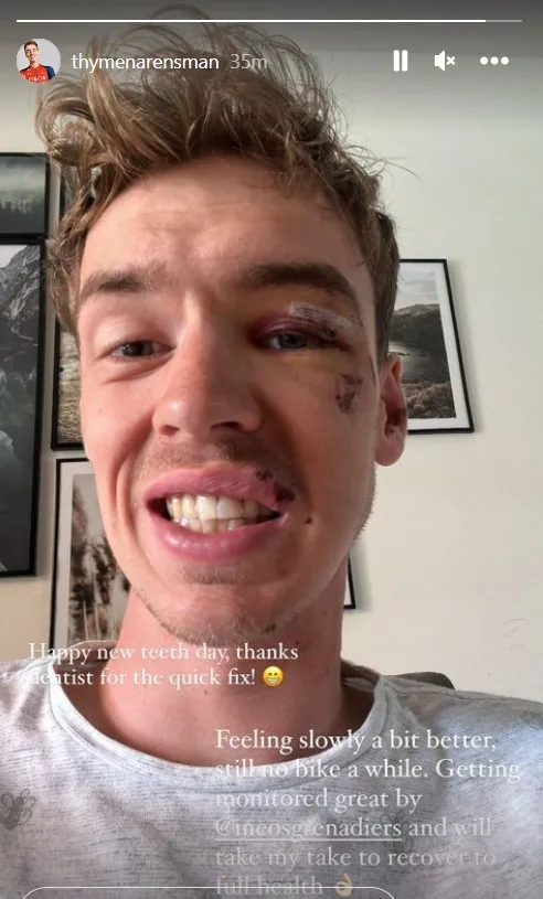 📸 'Tandarts, bedankt voor de quick fix'; Arensman toont gerepareerd gebit (en zit voorlopig niet op de fiets)