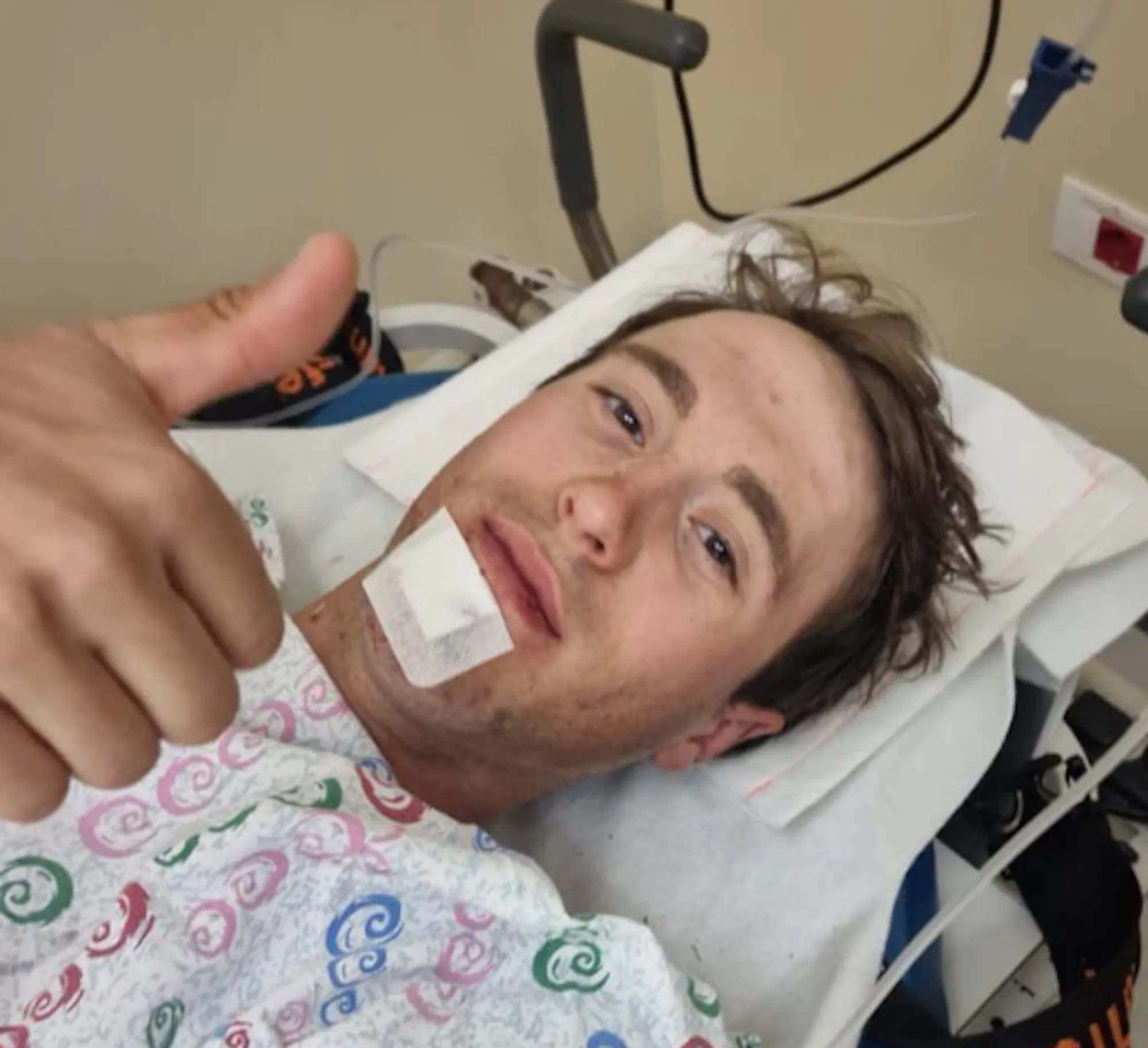 Na update over Roglic deelt nu ook Bardiani nieuws over horrorcrash Martinelli: geen breuken, slechts schaafwonden