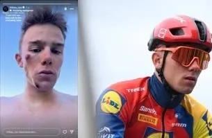 Thibau Nys komt tijdens afdaling in training ten val en deelt foto van verwondingen: 'Blij dat ik hier zonder al te veel erg vanaf kom'