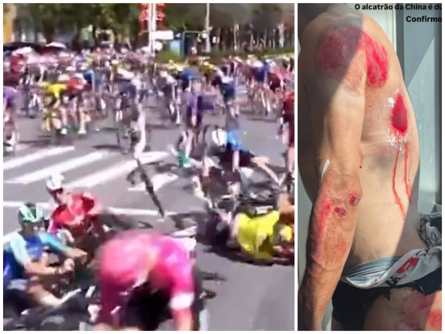 🎥 Reusachtige crash in eerste etappe China: Visma | Lease a Bike met meerdere renners op de grond, UAE hard geraakt